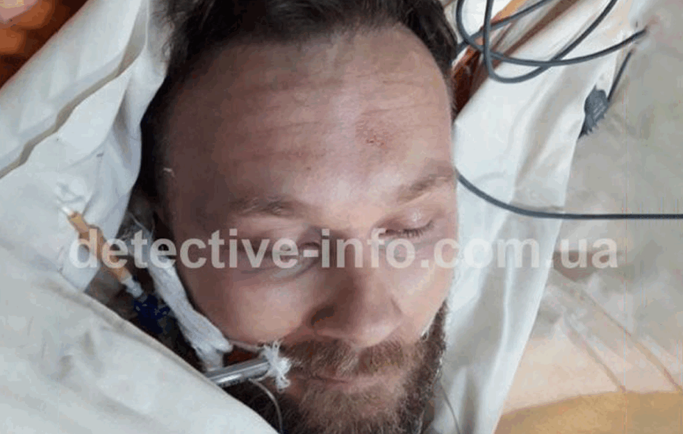 ZVICER PREŽIVEO SMRTONOSNO RANJAVANJE: Vođa kavačkog klana pušten iz bolnice